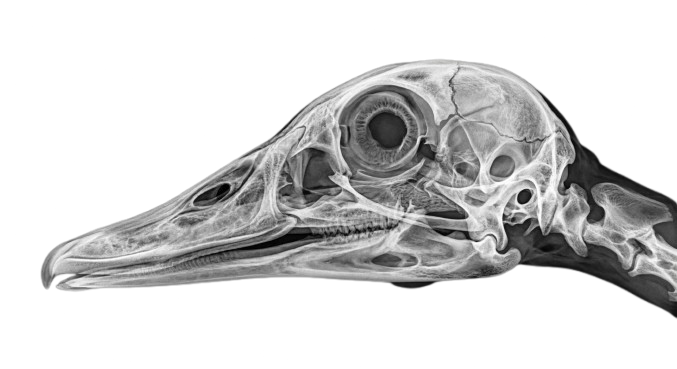 DICOM Skull
